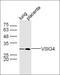 V-Set And Immunoglobulin Domain Containing 4 antibody, orb11565, Biorbyt, Western Blot image 