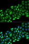 Receptor Interacting Serine/Threonine Kinase 2 antibody, LS-C332122, Lifespan Biosciences, Immunofluorescence image 