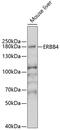 Erb-B2 Receptor Tyrosine Kinase 4 antibody, 22-023, ProSci, Western Blot image 