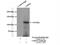 Ubiquitin Specific Peptidase 10 antibody, 19374-1-AP, Proteintech Group, Immunoprecipitation image 