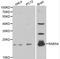 RAB5A, Member RAS Oncogene Family antibody, LS-C192438, Lifespan Biosciences, Western Blot image 