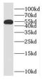 CWC27 Spliceosome Associated Cyclophilin antibody, FNab07664, FineTest, Western Blot image 