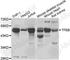 Transcription Factor EB antibody, A7311, ABclonal Technology, Western Blot image 