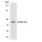 G Protein-Coupled Receptor Class C Group 5 Member D antibody, LS-C292028, Lifespan Biosciences, Western Blot image 