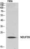 NADH:Ubiquinone Oxidoreductase Subunit B9 antibody, A08623, Boster Biological Technology, Western Blot image 