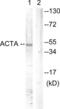Actin Alpha 1, Skeletal Muscle antibody, LS-C117789, Lifespan Biosciences, Western Blot image 