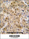 DEAD-Box Helicase 5 antibody, 62-930, ProSci, Immunohistochemistry paraffin image 