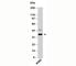 Nucleolar Protein Interacting With The FHA Domain Of MKI67 antibody, N1157-100UG, NSJ Bioreagents, Western Blot image 