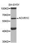 Activin A Receptor Type 1C antibody, A0678, ABclonal Technology, Western Blot image 