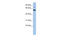 NADP-dependent malic enzyme antibody, 25-093, ProSci, Enzyme Linked Immunosorbent Assay image 