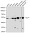 Solute Carrier Family 2 Member 1 antibody, 22-604, ProSci, Western Blot image 