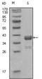 ABL Proto-Oncogene 1, Non-Receptor Tyrosine Kinase antibody, AM06256SU-N, Origene, Western Blot image 