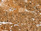 Akt substrate of 160 kDa antibody, CSB-PA182529, Cusabio, Immunohistochemistry paraffin image 