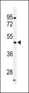 Cyclin Dependent Kinase 14 antibody, LS-C164999, Lifespan Biosciences, Western Blot image 