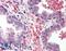 Eukaryotic Translation Initiation Factor 4E Binding Protein 1 antibody, LS-B564, Lifespan Biosciences, Immunohistochemistry paraffin image 