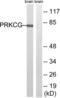 Protein Kinase C Gamma antibody, abx012999, Abbexa, Western Blot image 