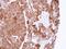 Pyrophosphatase (Inorganic) 1 antibody, NBP1-31348, Novus Biologicals, Immunohistochemistry paraffin image 