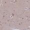 Clavesin 2 antibody, PA5-60501, Invitrogen Antibodies, Immunohistochemistry paraffin image 