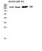 Protein Tyrosine Kinase 2 antibody, STJ93027, St John
