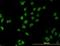Mesenchyme Homeobox 2 antibody, orb94708, Biorbyt, Immunocytochemistry image 