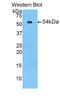 Carboxyl Ester Lipase antibody, LS-C298180, Lifespan Biosciences, Western Blot image 