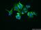 Leucine Rich Repeats And Calponin Homology Domain Containing 1 antibody, 25017-1-AP, Proteintech Group, Immunofluorescence image 