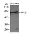 Protein Kinase C Zeta antibody, 79-411, ProSci, Western Blot image 