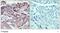 Janus Kinase 2 antibody, GTX79031, GeneTex, Immunohistochemistry paraffin image 