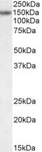 Transmembrane Protein 205 antibody, 42-691, ProSci, Western Blot image 