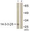 Tyrosine 3-Monooxygenase/Tryptophan 5-Monooxygenase Activation Protein Zeta antibody, GTX03589, GeneTex, Western Blot image 