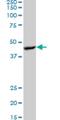 Protein Kinase AMP-Activated Non-Catalytic Subunit Beta 1 antibody, H00005564-M07, Novus Biologicals, Western Blot image 