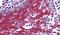 Forkhead Box O3 antibody, PA1-9042, Invitrogen Antibodies, Immunohistochemistry paraffin image 
