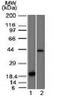 Aurora Kinase B antibody, 33-614, ProSci, Western Blot image 