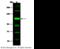 Protein Kinase D2 antibody, 11671-T54, Sino Biological, Western Blot image 