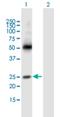 Membrane Spanning 4-Domains A3 antibody, H00000932-B01P, Novus Biologicals, Western Blot image 