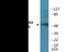 Calcium/Calmodulin Dependent Protein Kinase IV antibody, EKC2223, Boster Biological Technology, Western Blot image 