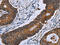 Isocitrate Dehydrogenase (NADP(+)) 2, Mitochondrial antibody, CSB-PA586287, Cusabio, Immunohistochemistry paraffin image 