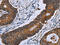 IDH antibody, CSB-PA586287, Cusabio, Immunohistochemistry paraffin image 