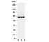 Checkpoint Kinase 2 antibody, R30740, NSJ Bioreagents, Western Blot image 