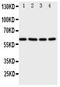 Receptor Interacting Serine/Threonine Kinase 2 antibody, PA1861, Boster Biological Technology, Western Blot image 