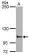 ATP Binding Cassette Subfamily F Member 1 antibody, GTX114228, GeneTex, Western Blot image 