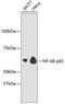 p65 antibody, 13-935, ProSci, Western Blot image 