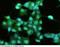 Fatty Acid Binding Protein 6 antibody, 12579-R201, Sino Biological, Immunohistochemistry paraffin image 