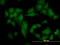 Casein Kinase 2 Alpha 1 antibody, LS-C196985, Lifespan Biosciences, Immunofluorescence image 
