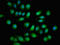 Transducer Of ERBB2, 1 antibody, LS-C671247, Lifespan Biosciences, Immunofluorescence image 