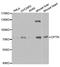 Optineurin antibody, MBS126450, MyBioSource, Western Blot image 