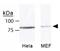 MRE11 Homolog, Double Strand Break Repair Nuclease antibody, GTX30294, GeneTex, Western Blot image 