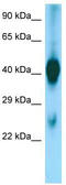 Asialoglycoprotein Receptor 1 antibody, TA334278, Origene, Western Blot image 