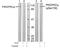 Protein Kinase D1 antibody, GTX38607, GeneTex, Western Blot image 