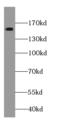FA Complementation Group A antibody, FNab03004, FineTest, Western Blot image 